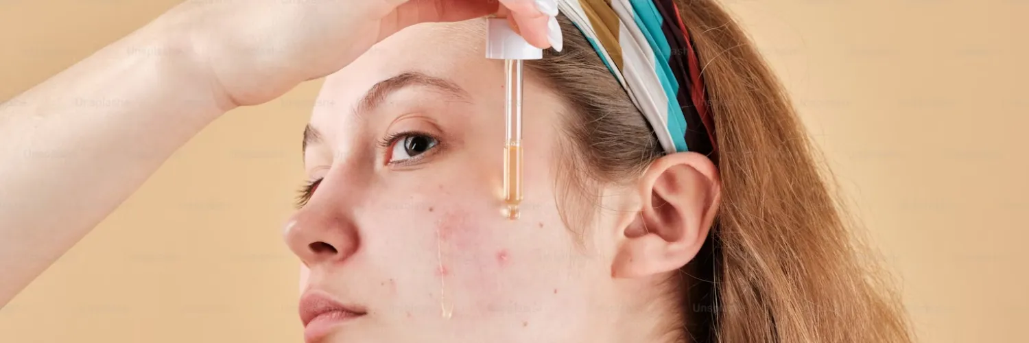 Phyla: Revolutionizing Acne Treatment with Probiotic Phages